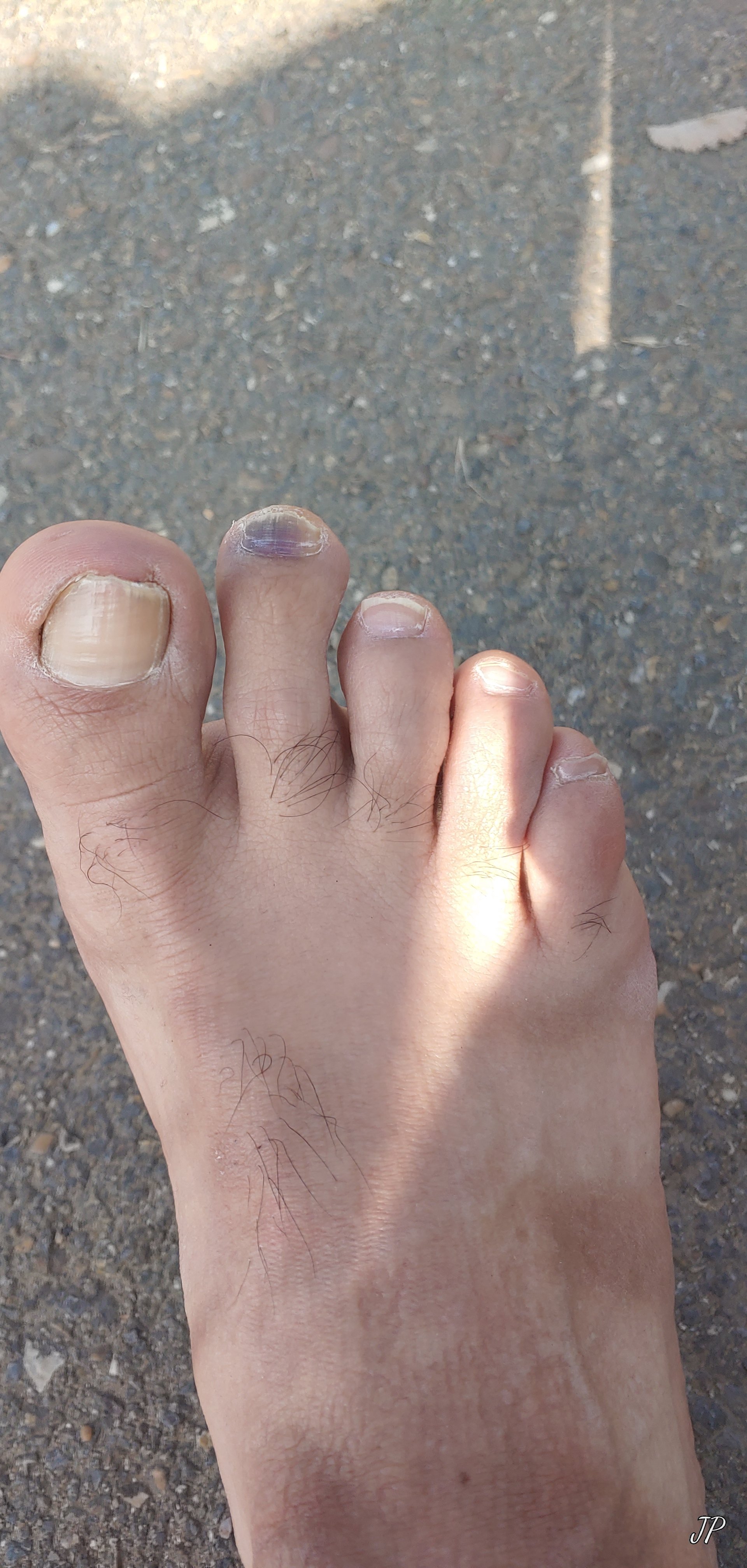 A pilgrim's foot after the miles